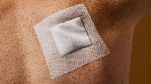 Close-up of a Hypafix dressing fixating a gauze on a joint and image showing Hypafix benefits: reliable adhesion, highest stretchability, high MVTR rate. Close-up of a Hypafix dressing fixating a gauze on a joint and image showing Hypafix benefits: reliable adhesion, highest stretchability, high MVTR rate.